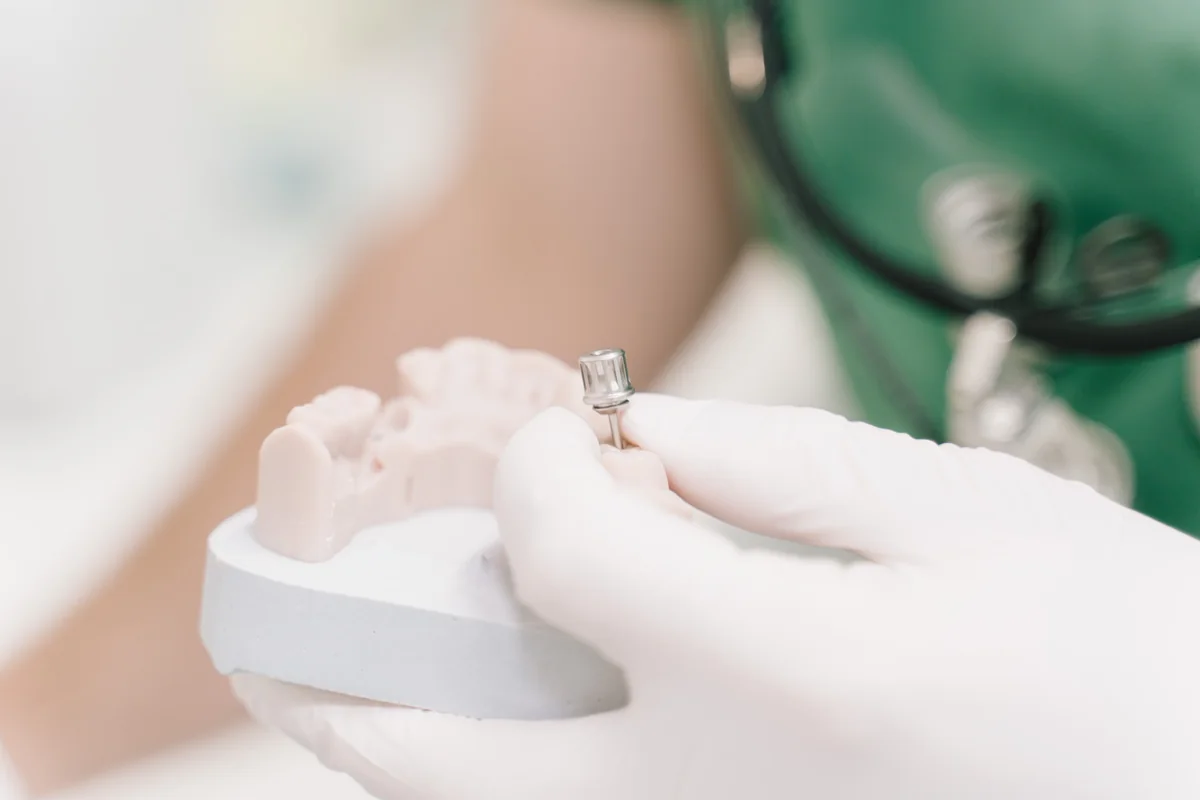 Ein Implantat wird über einem Kiefermodell angepasst